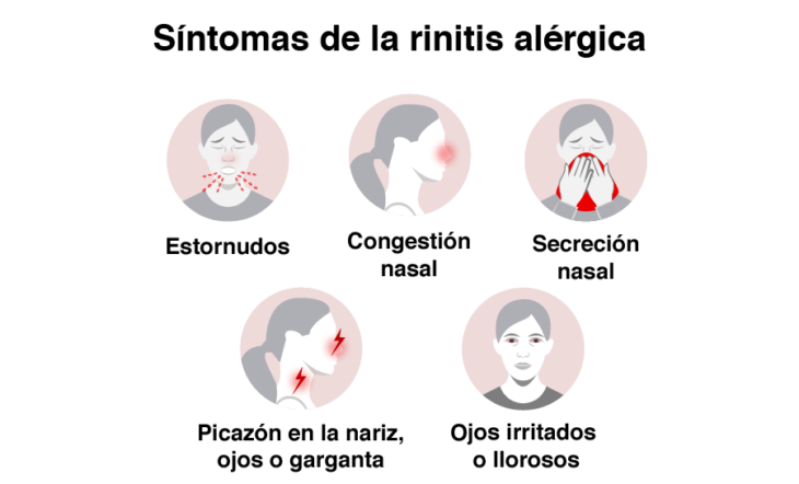 Infografía de síntomas de alergia 