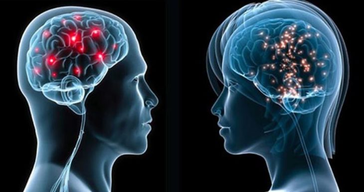 Radiografía de dos cerebros, uno de mujer y otro de hombre