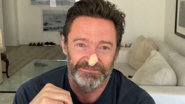 Hugh Jackman con un parche en la nariz después de una biopsia