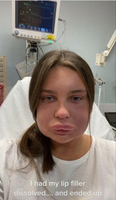 cara hinchada de una chica en un hospital