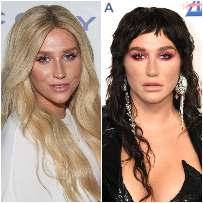 Kesha