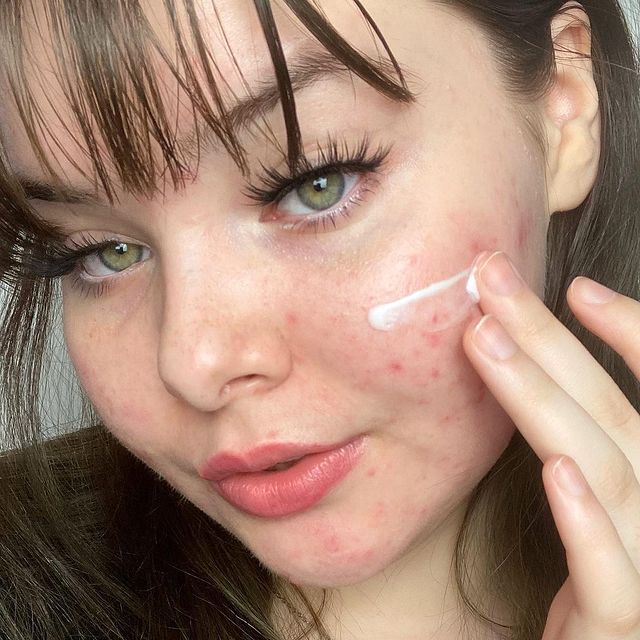 chica cuidando su piel; 'Skin positive', el movimiento que hará que ames las imperfecciones de tu piel
