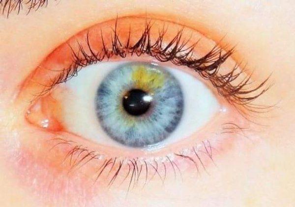 Pupila de dos colores ;13 Personas con rasgos tan únicos que te enamorarán a primera vista