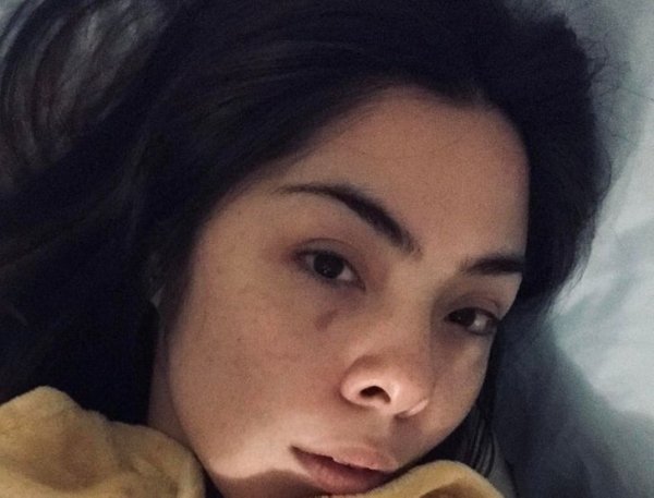 Chica con lunar de lágrima ;13 Personas con rasgos tan únicos que te enamorarán a primera vista