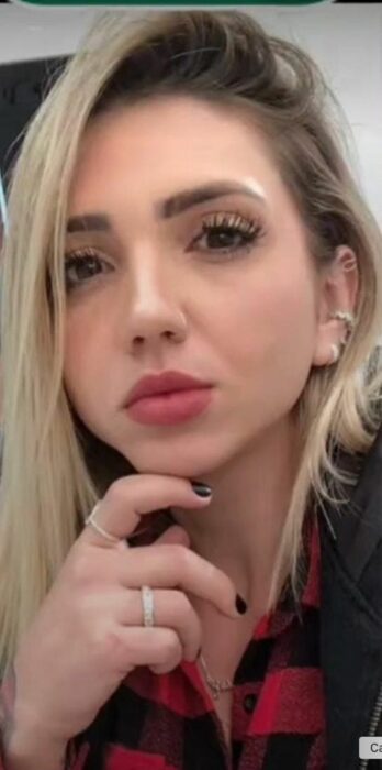 Mujer influencer mostrando el resultado de su bichectomía 