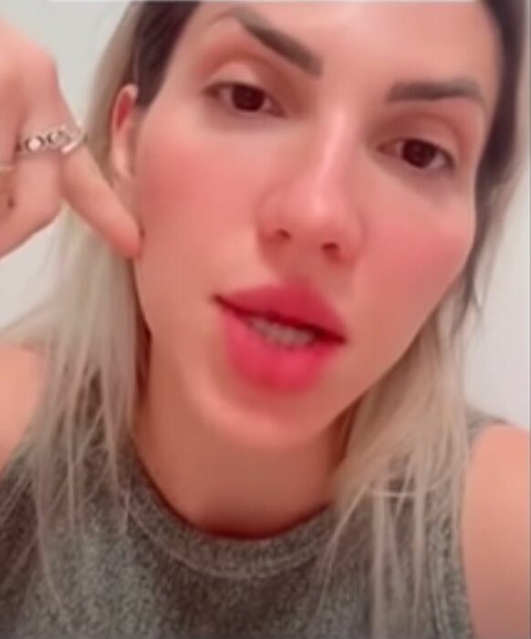 Mujer influencer mostrando el resultado de su bichectomía 