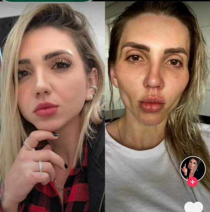 Mujer influencer mostrando el resultado de su bichectomía 