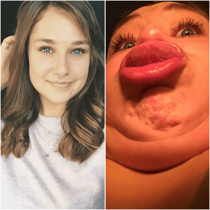 chicas demuestran en reddit que los ángulos pueden cambiar cómo te ves bella o rara