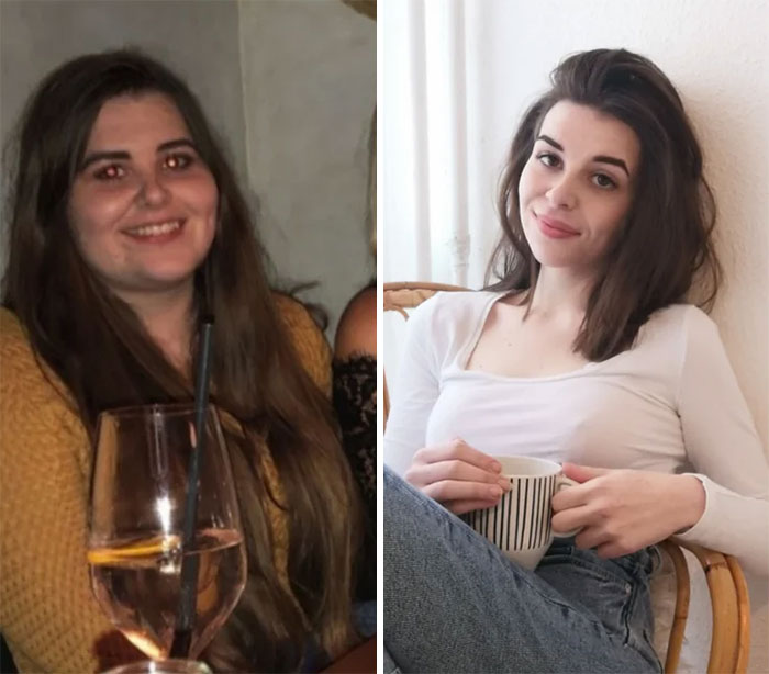 Chica mostrando el antes y después de su pérdida de peso