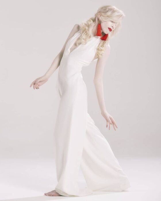 Ruby Vizcarra, modelo albina mexicana posando para una sesión de fotos mientras usa un vestido blanco largo