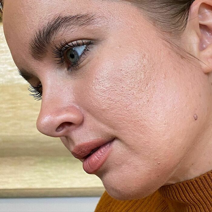 Close up de chica con piel clara mostrando sus poros grandes 