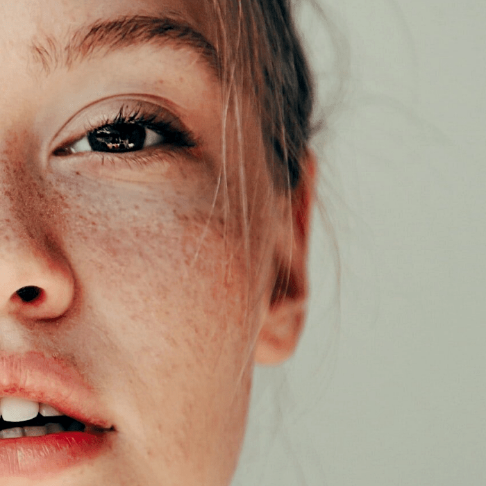 chica rubia con pecas