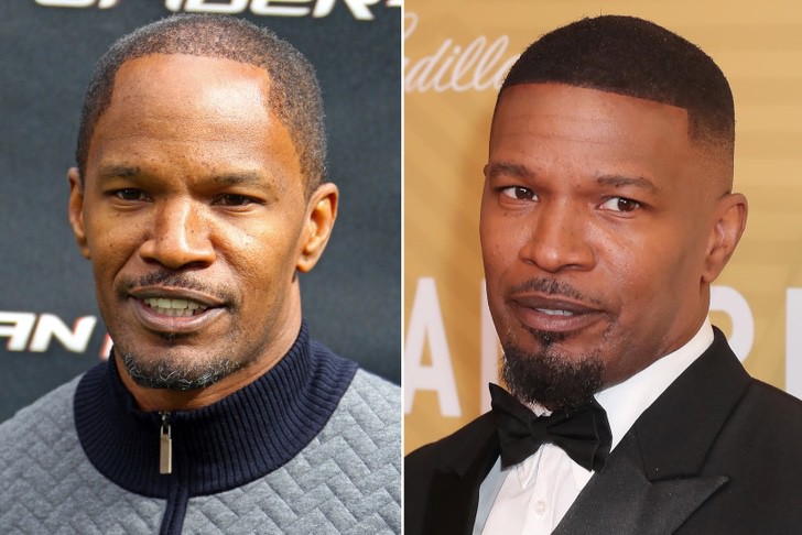 Jamie Foxx antes y después del injerto de cabello