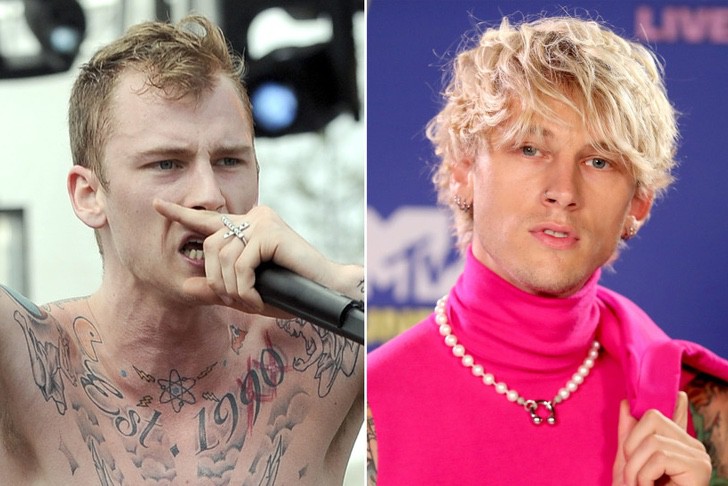 Machine Gun Kelly antes y después de su injerto de cabello