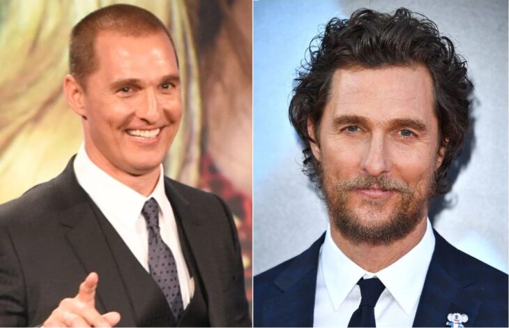 Matthew McConaughey antes y después del injerto de cabello