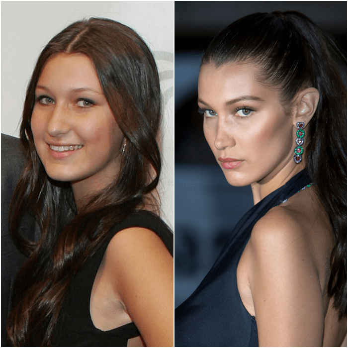 bella hadid cuando era adolescente, cambios físicos