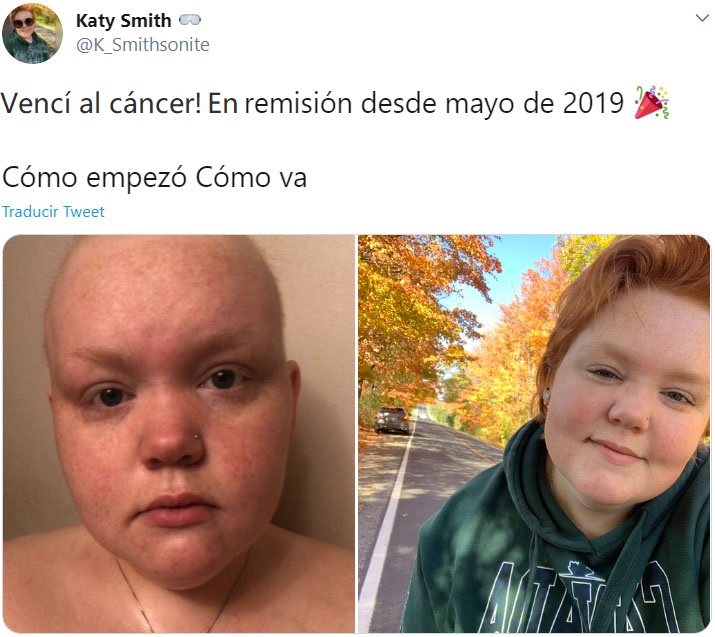 Captura de Twitter de una mujer participando en el reto "Cómo empezó vs Cómo terminó" en su lucha contra el cáncer