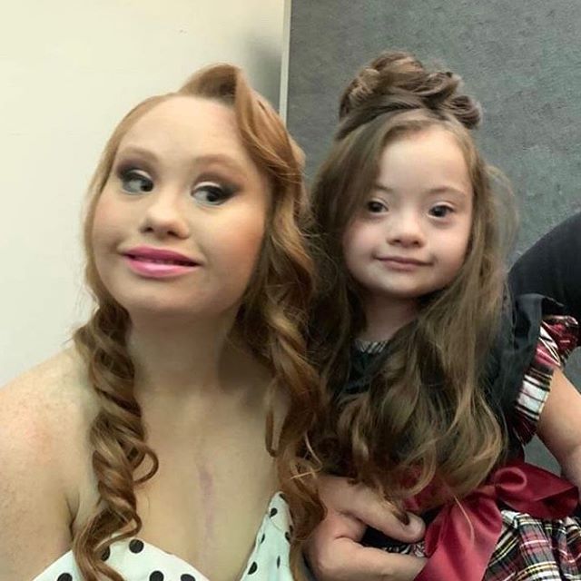 Francesca Rausi y Madeline Stuart