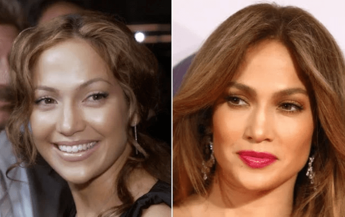 Jennifer Lopez cejas antes y después