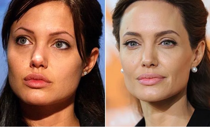Angelina Jolie cejas antes y después