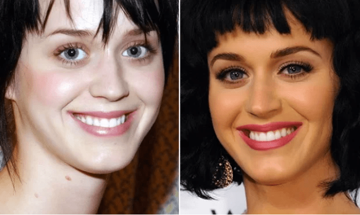 Katy Perry cejas antes y después