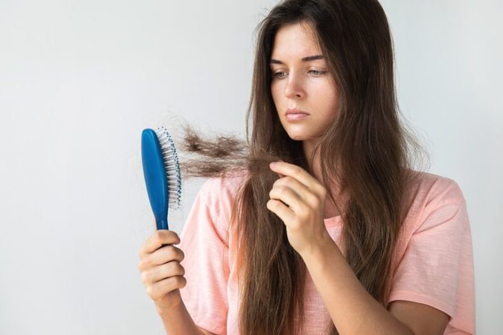 Chica con pérdida de cabello