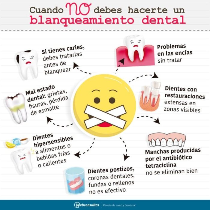 Infografía sobre cuando no debes realizar un blanqueamiento dental