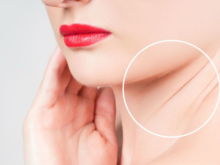 Cuello de una chica donde se muestra la perdida de firmeza del mismo