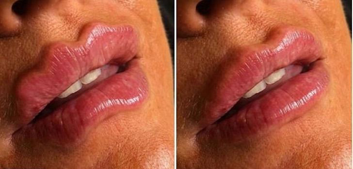 Chica mostrando el antes y después de sus labios endemoniados