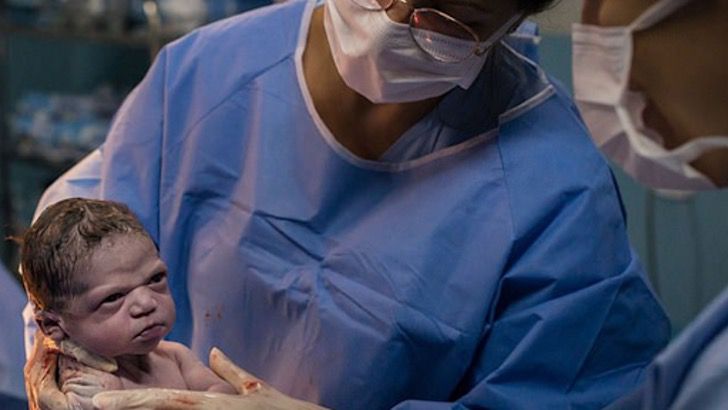 Bebé que nació con el rostro enojado viendo a los doctores 
