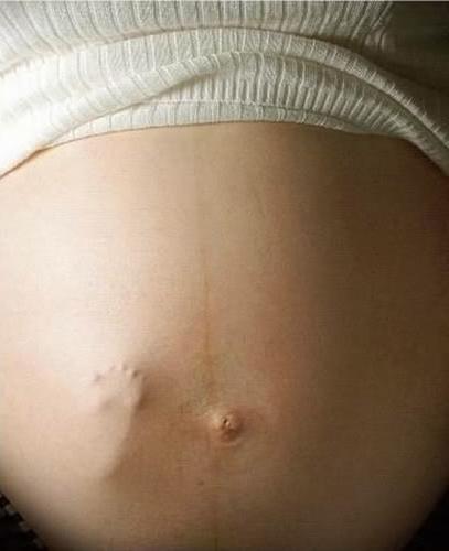 Panza de una embarazada mostrando el piecito de su bebé