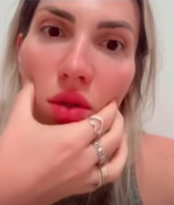Mujer influencer mostrando el resultado de su bichectomía 