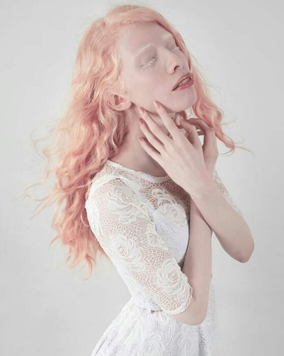 Ruby Vizcarra, modelo albina mexicana posando para una foto mientras usa un vestido blanco